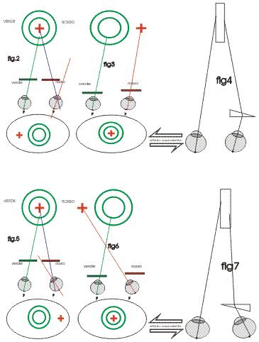 schober con exoforia